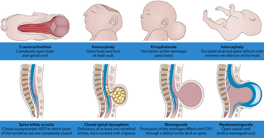 neural tube